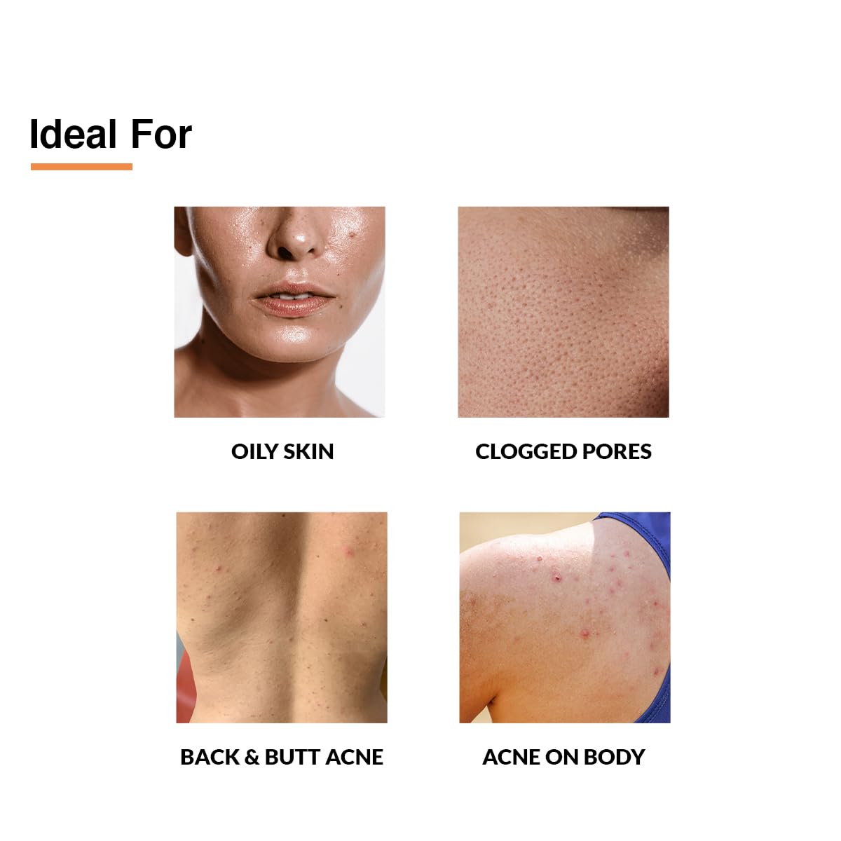 Fixderma Salyzap Body Spray